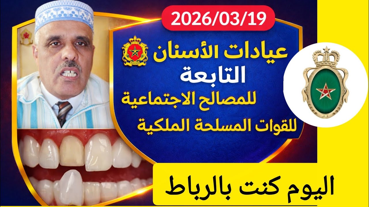 صايبت فم الأسنان ب 175درهم زرت عيادات طب الأسنان التابعة للمصالح الاجتماعية للقوات المسلحة الملكية 