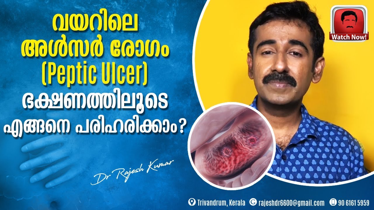 വയറിലെ അൾസർ രോഗം (Peptic Ulcer) ഭക്ഷണത്തിലൂടെ എങ്ങനെ പരിഹരിക്കാം ?