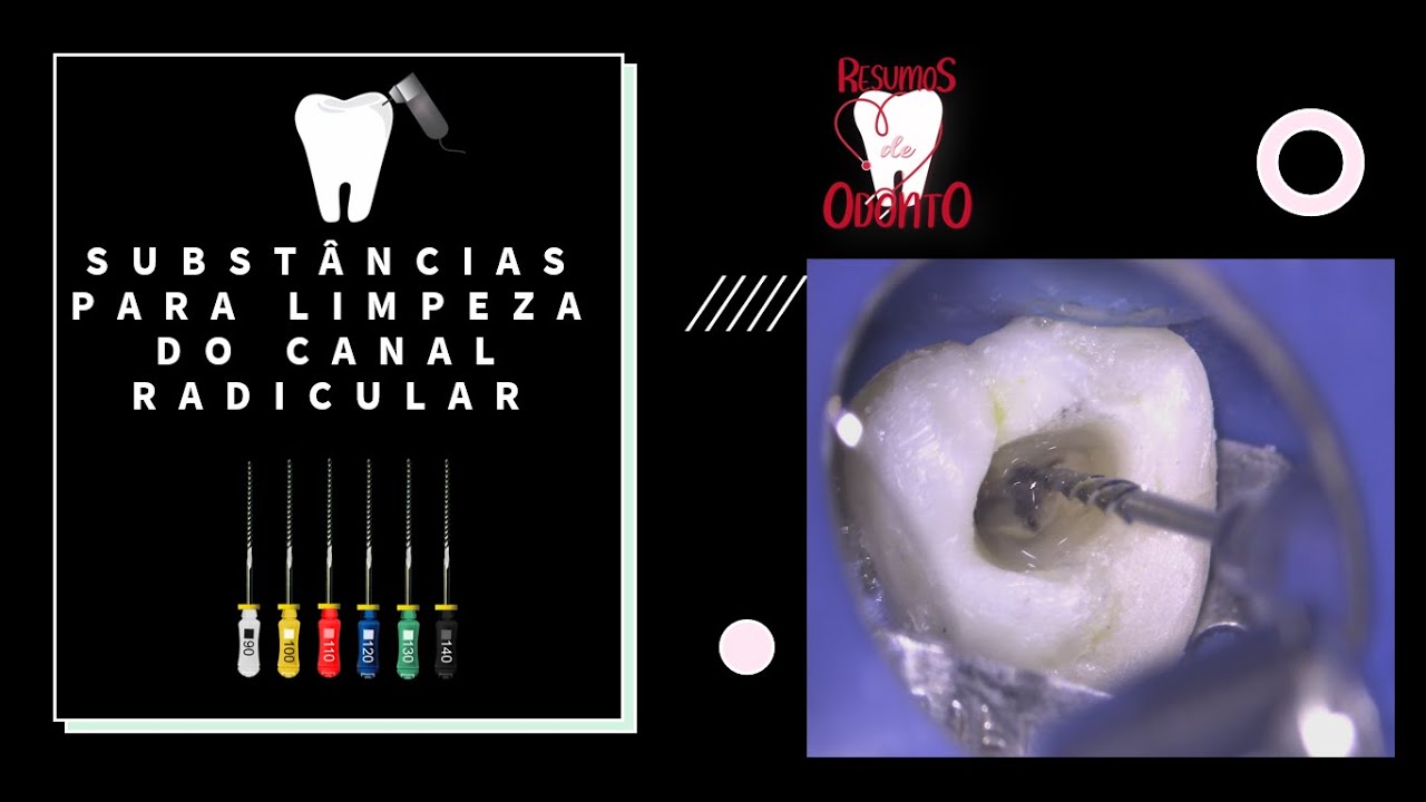 Soluções irrigadoras para tratar canal endodôntico | Resumos de Odonto