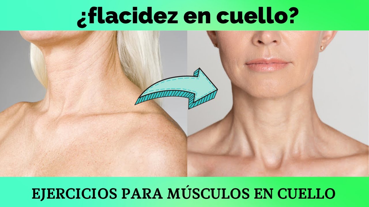Cómo quitar la FLACIDEZ DE CUELLO / Ejercicios para mejorar la fuerza muscular de cuello