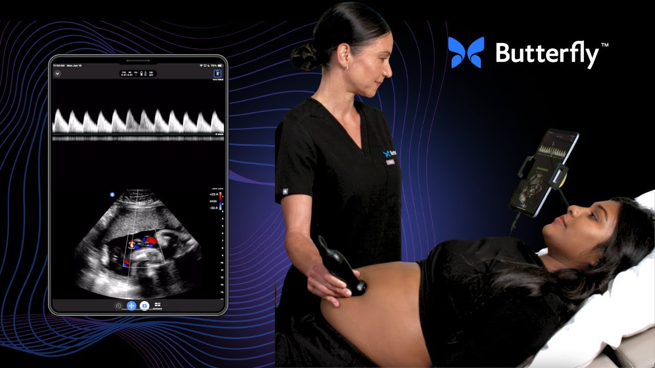 Umbilical Artery Doppler | Butterfly Network