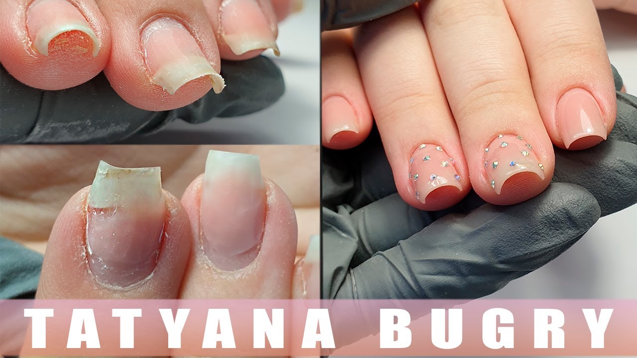 Исправляю Скрученные Ногти/ Коррекция СЛОЖНЫХ Ногтей/ Татьяна Бугрий