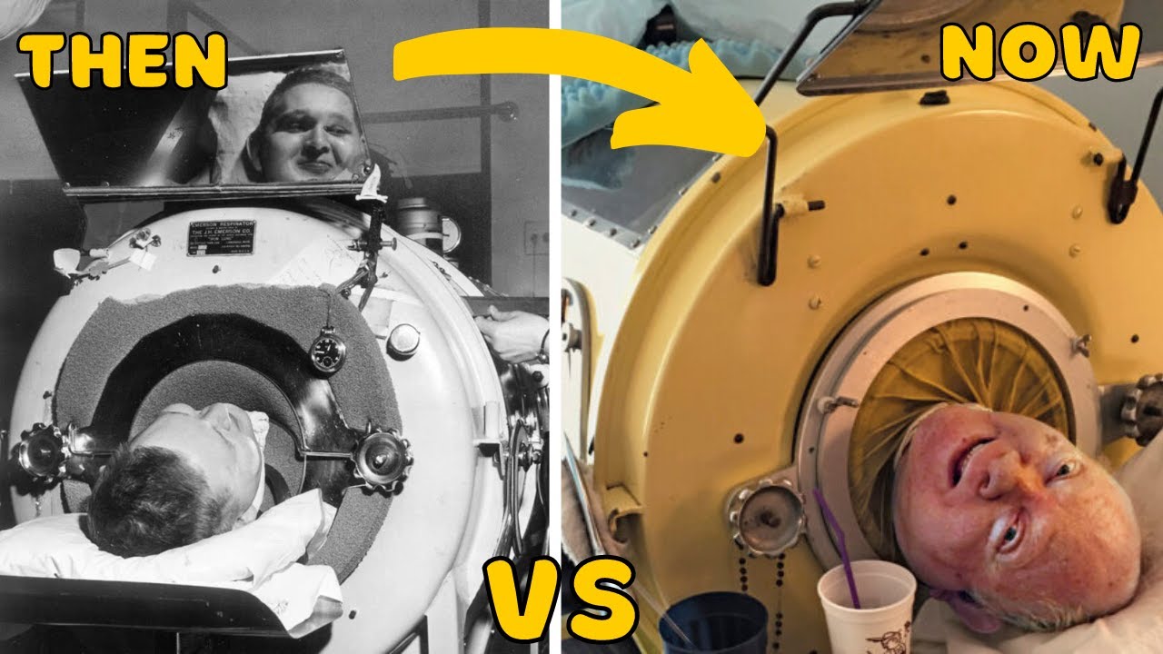 Man Locked in This Machine For Almost 70 Years