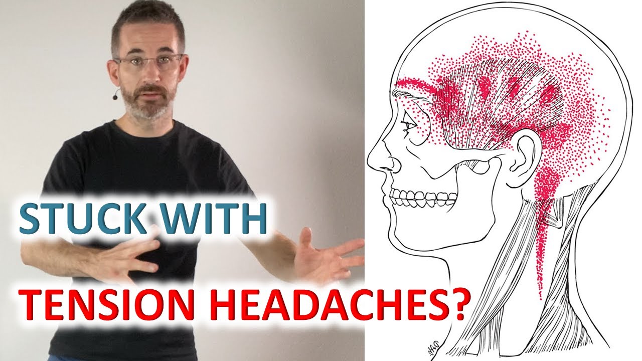 Tension Headache Relief: How To Fix The Pain | Stressed Out, Forward Head Posture Or Both?