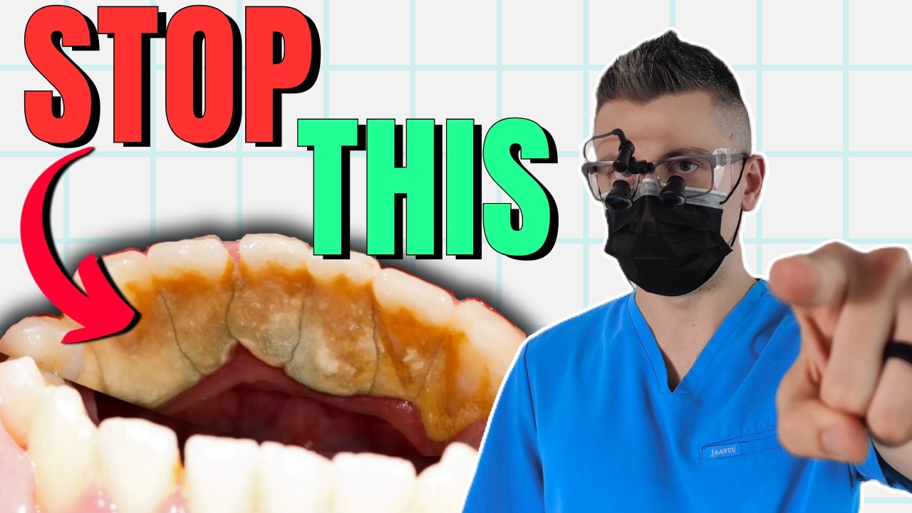 Prevent Tartar Buildup on Your Teeth