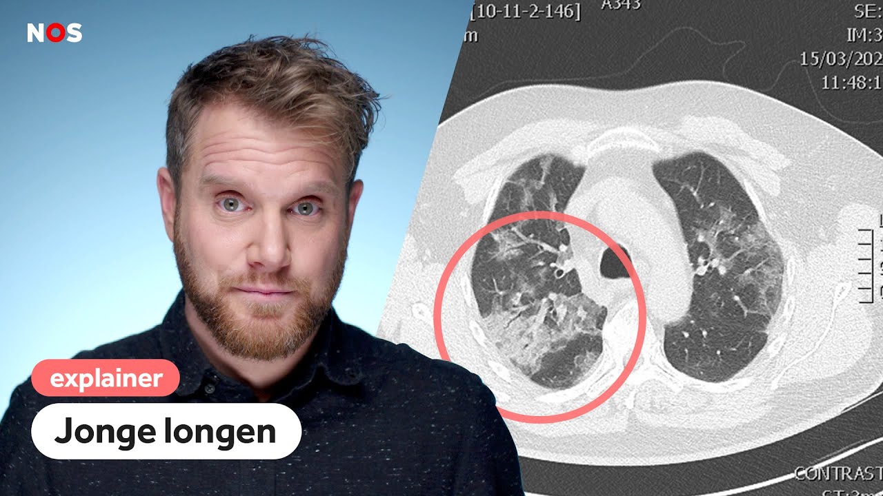 Wat corona met je doet