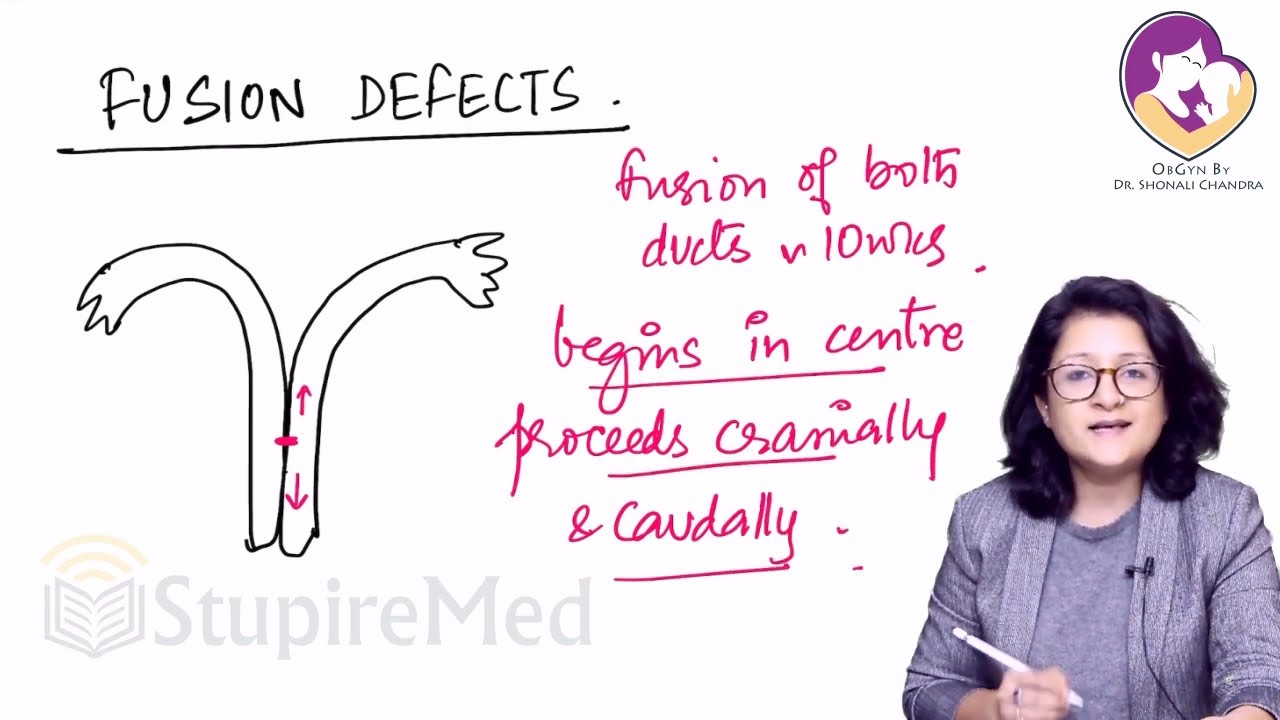 Clinical shots of Mullerian Anomalies by Dr. Shonali Chandra