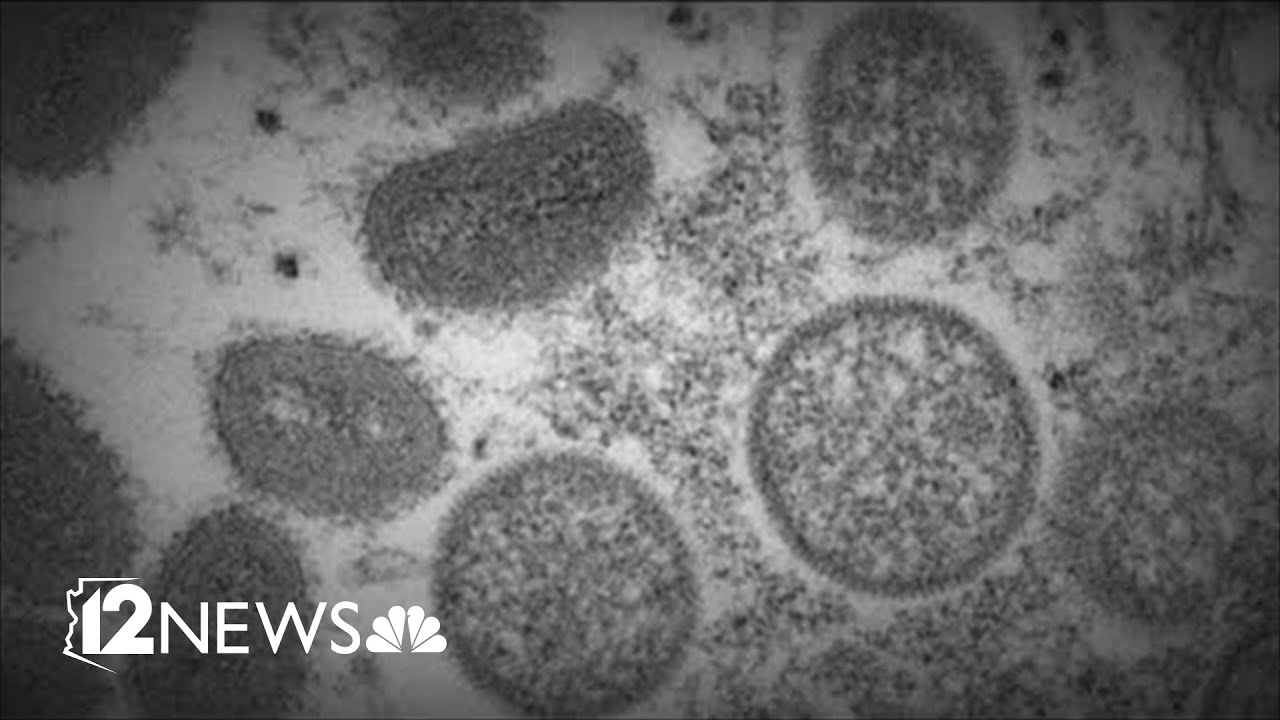 Maricopa County to prioritize high-risk people for monkeypox vaccine