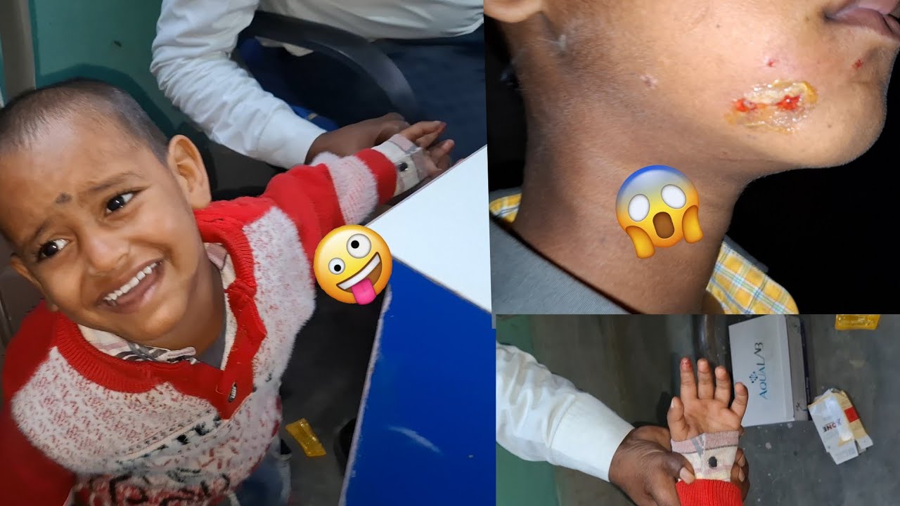 Rounak is hurt😓|babu ka Reaction 🤪