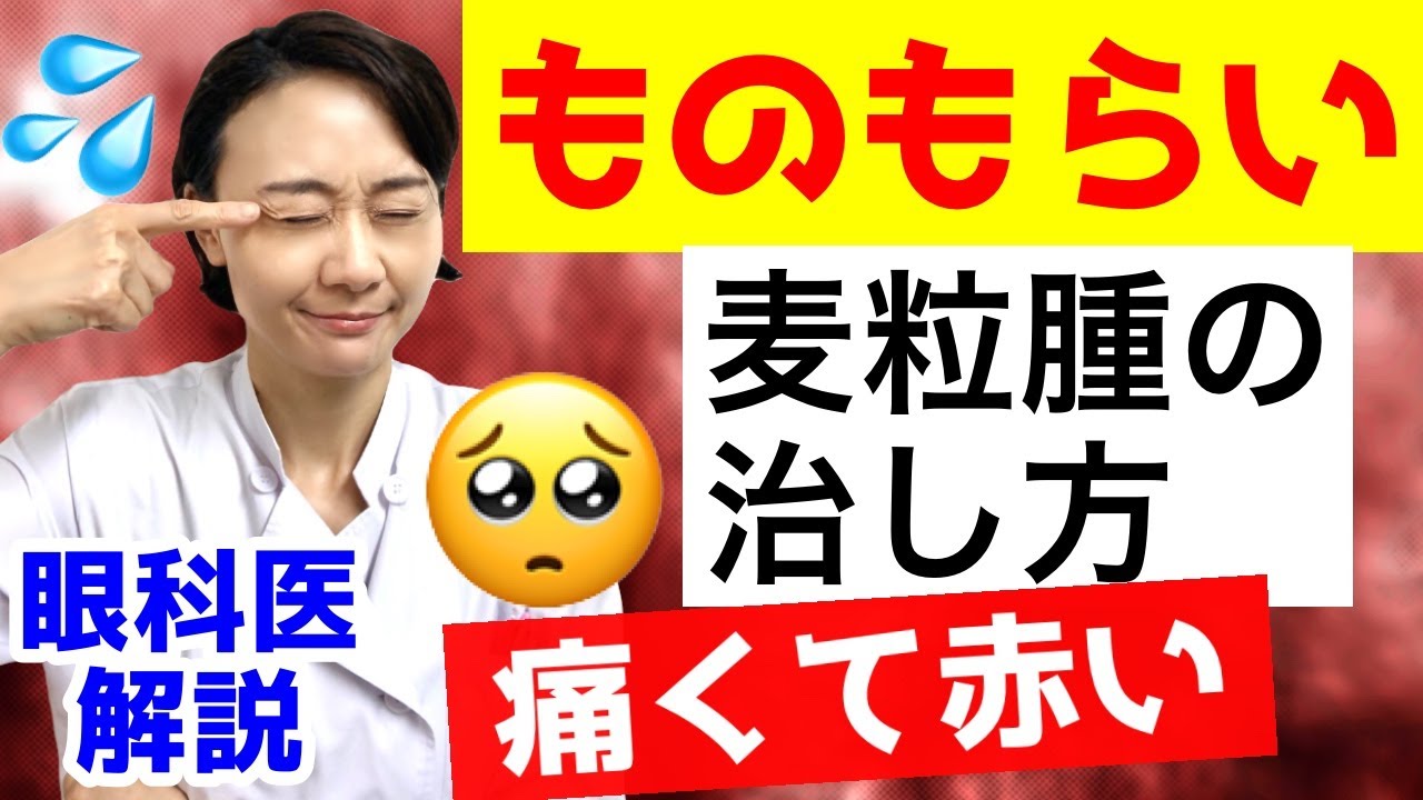 【ものもらい】麦粒腫の治し方！（痛くて赤い）眼科医解説！