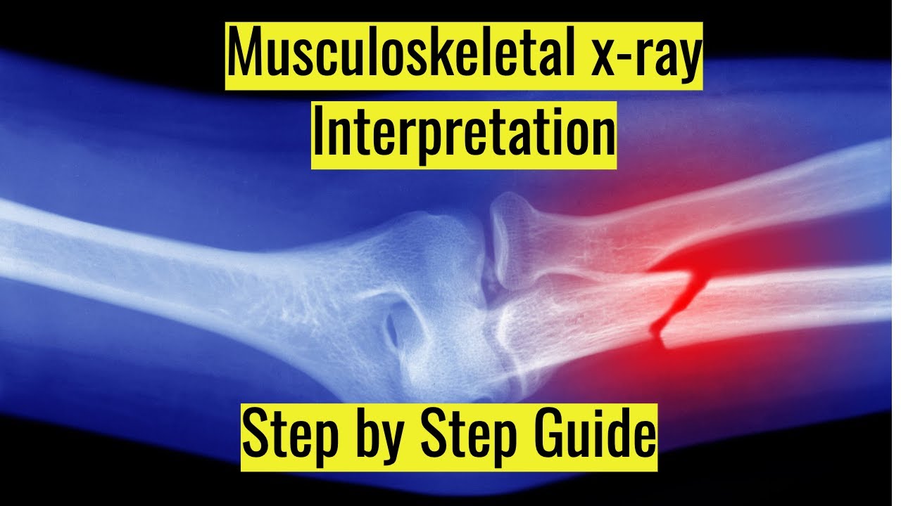 🤯 Musculoskeletal x ray interpretation, Complete step by step guide.