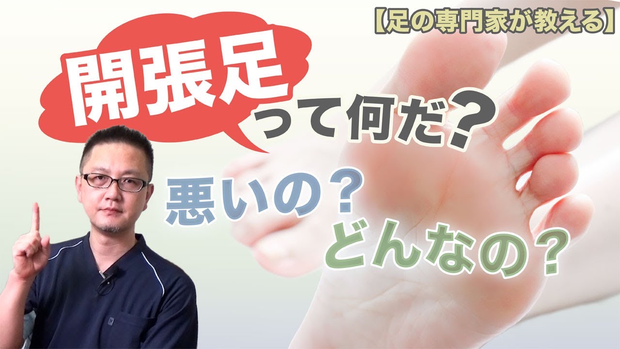 【足の専門家が教える】「開張足」とはどんな状態で、どんな影響があるのか？