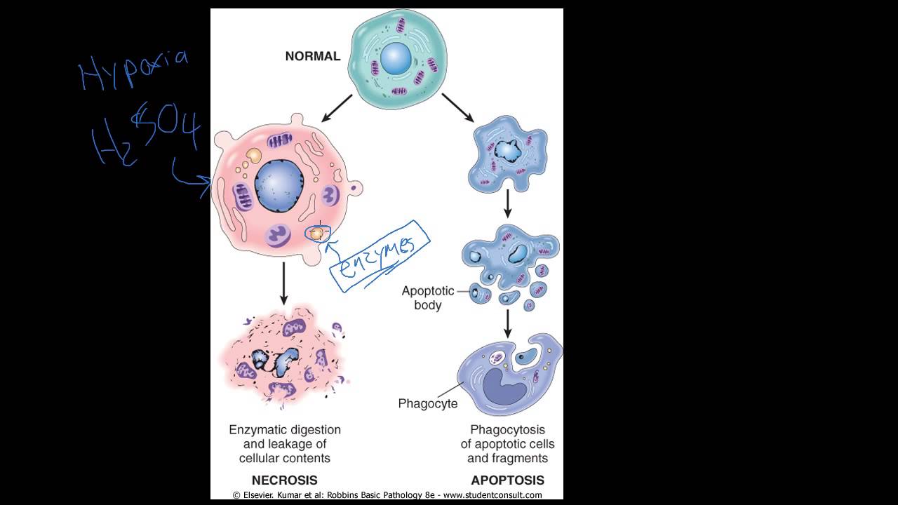 #4 - Introduction to Pathology - Necrosis vs. Apoptosis