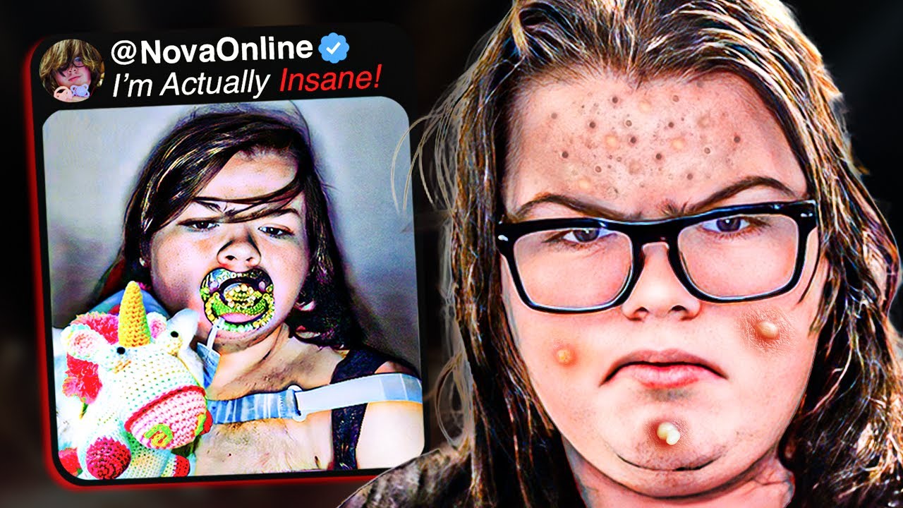The Creepy DIAPER Wearing Influencer Is GETTING WORSE…