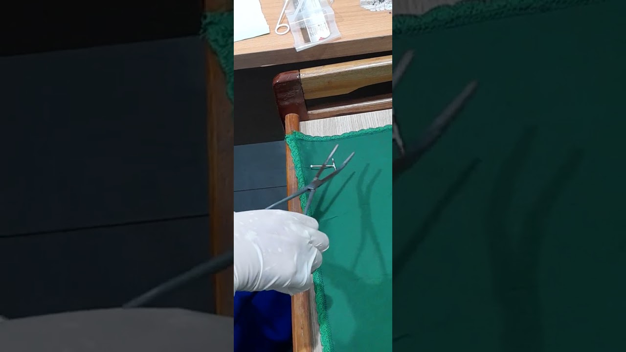 Pelepasan IUD