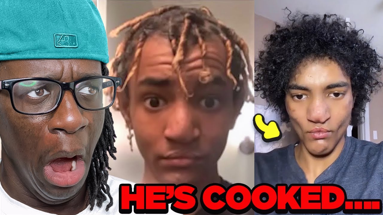 GOOFY Tiktoker Ruins His Face From Looksmaxxing&hellip; (he chopped af)