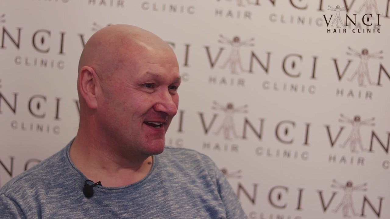 Vinci Hair Clinic Manchester Micro Scalp Pigmentation