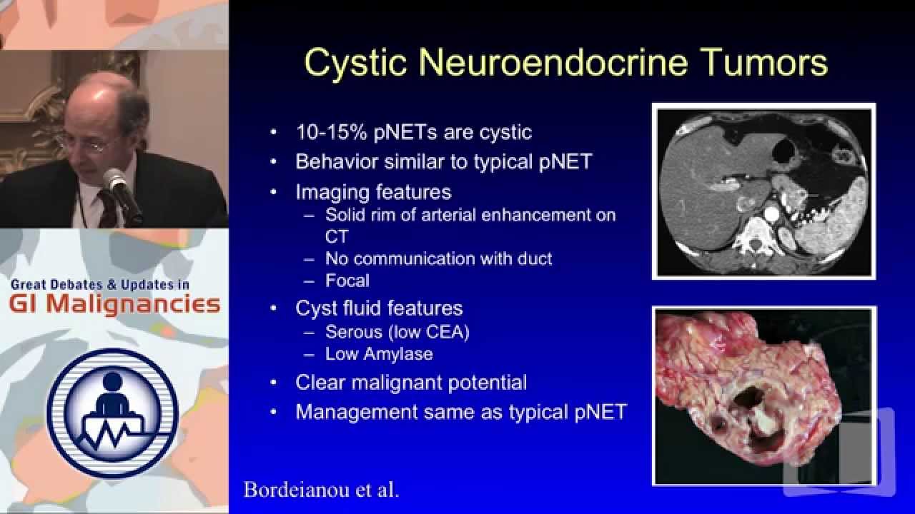 Update 9: Spectrum of Low-Grade/Cystic Pancreatic Neoplasms and their Management