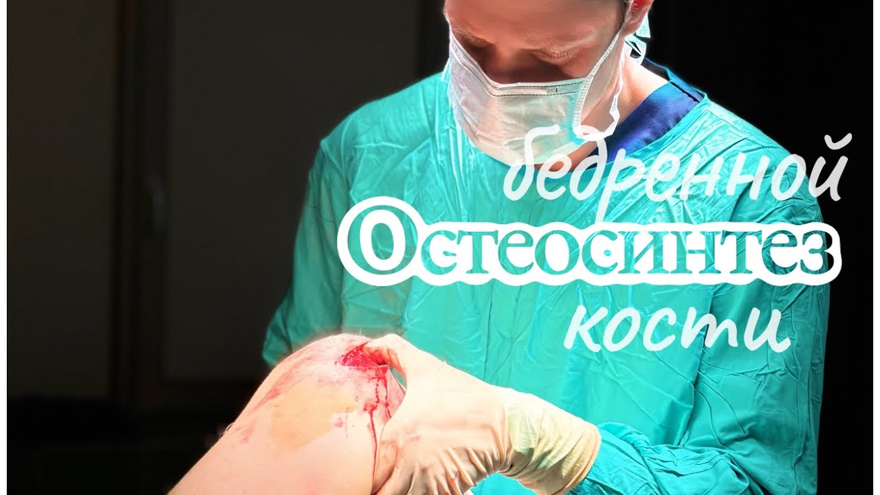 Остеосинтез бедренной кости.