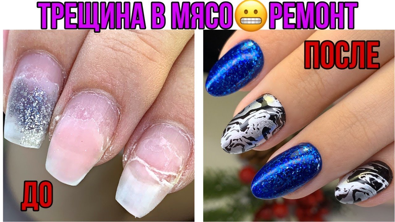Почему сломался ноготь?😱Коррекция после другого мастера💅Последствия неправильной архитектуры😱