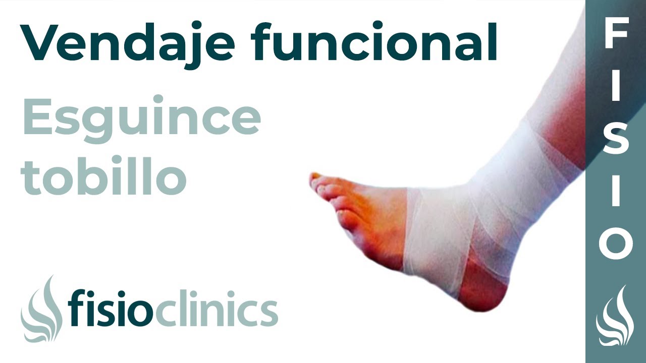 Vendaje funcional para esguince o torcedura de tobillo - FisioClinics Palma de Mallorca