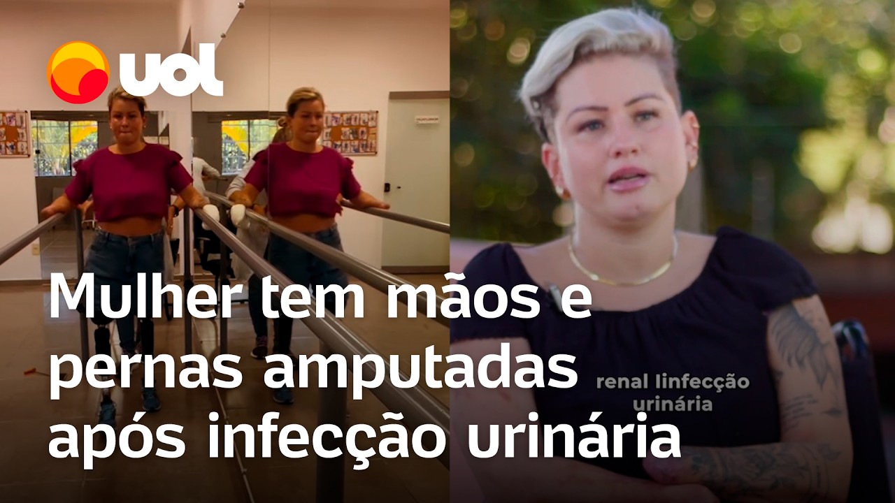 Mulher tem mãos e pernas amputadas após infecção urinária: 'Sou grata por estar viva'; entenda
