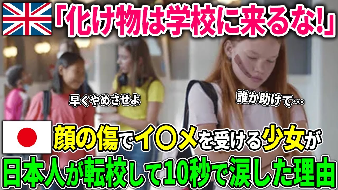 【海外の反応】顔に傷のあるイギリスの少女が日本人が転向して10秒後に涙した理由