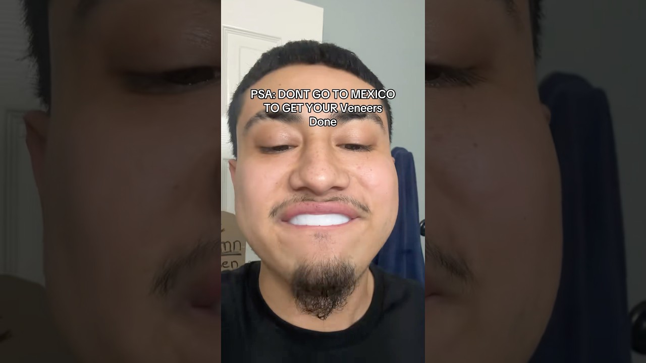 Why You Shouldn&rsquo;t Buy CHEAP Veneers! 😮🦷