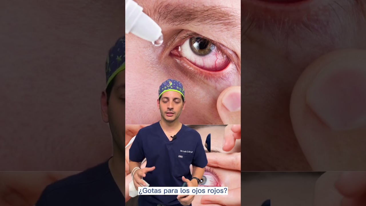 NO lo hagas, si tienes ojo rojo‼️👁️