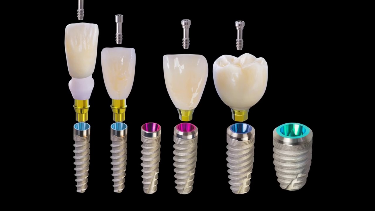 Doctors discuss the benefits of the  Hahn Tapered Implant System
