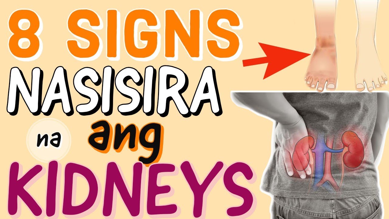 8 Warning Signs na Sira ang Kidneys - Payo ni Doc Willie Ong #204