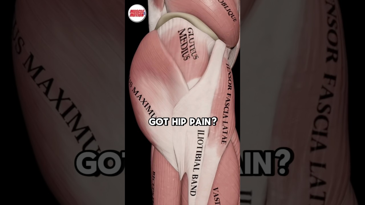 How To Fix Hip Pain (SCIATICA)