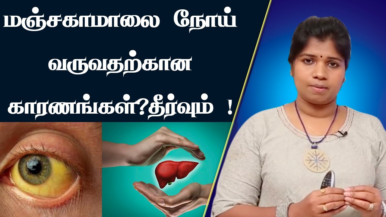 மஞ்சள் காமாலை உருவாகக் காரணம் மற்றும் தீர்வு | Jaundice | Hepatitis A & B |  Dr. B.Yoga Vidhya