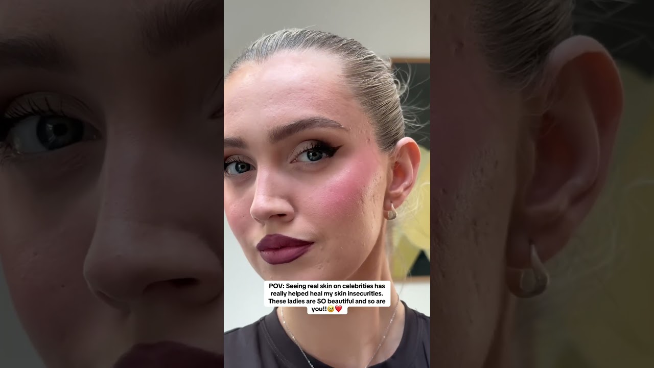 Celebrities have skin texture too!❤️ #makeup #skin #realskin #selfcare #selfcaretips #loveyourself