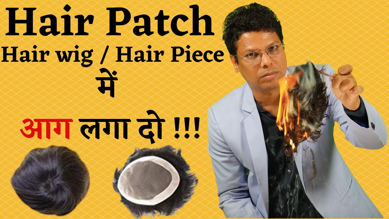 Watch this before using Hair Patch (WIG लगाने वाले सावधान !!) || Dr. Ashok Sinha