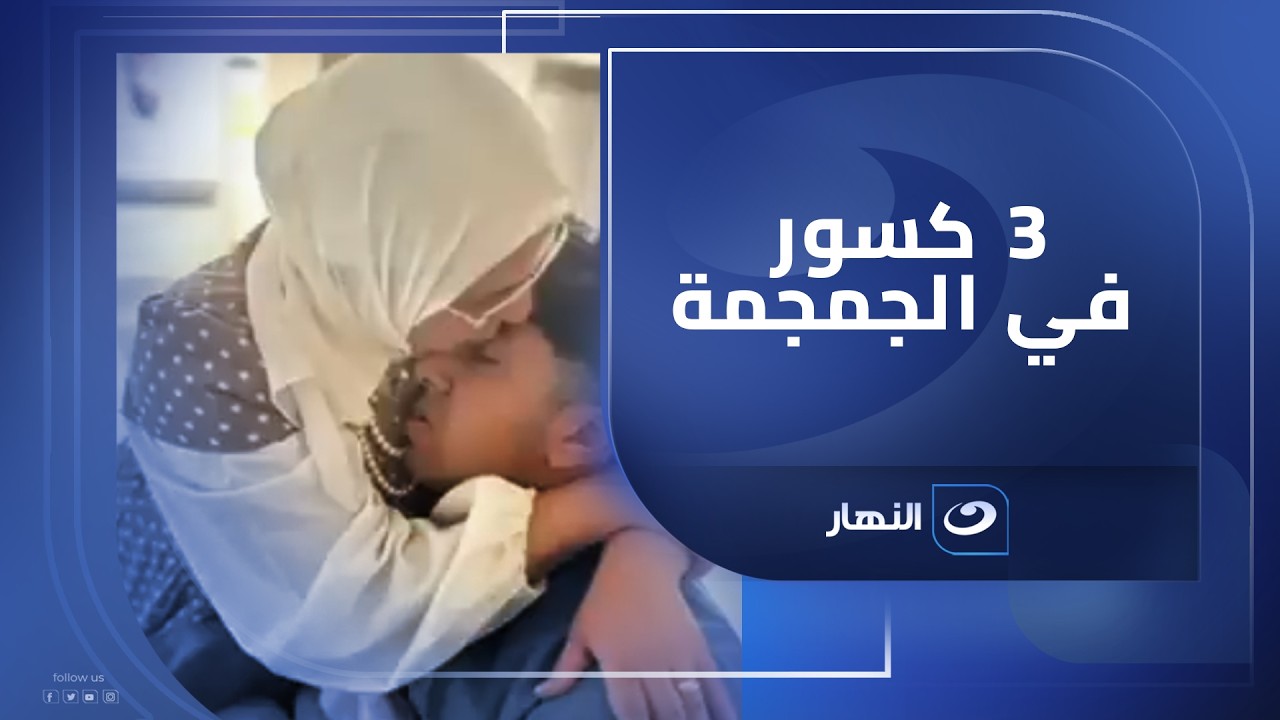 ابنها تعرّض لـ3 كسور في الجمجمة بسب أبن أخوها 😢