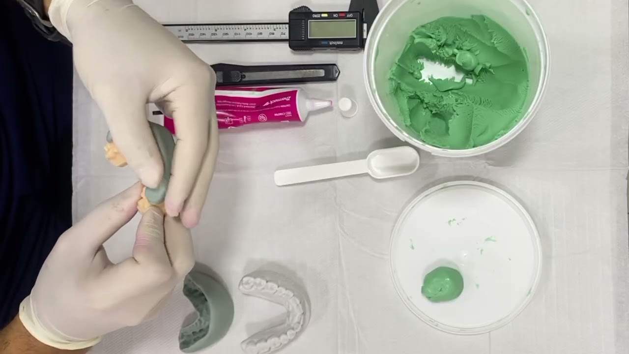 Confecção das guias para mock-up e preparo em restaurações estéticas tipo lentes de contato dental.