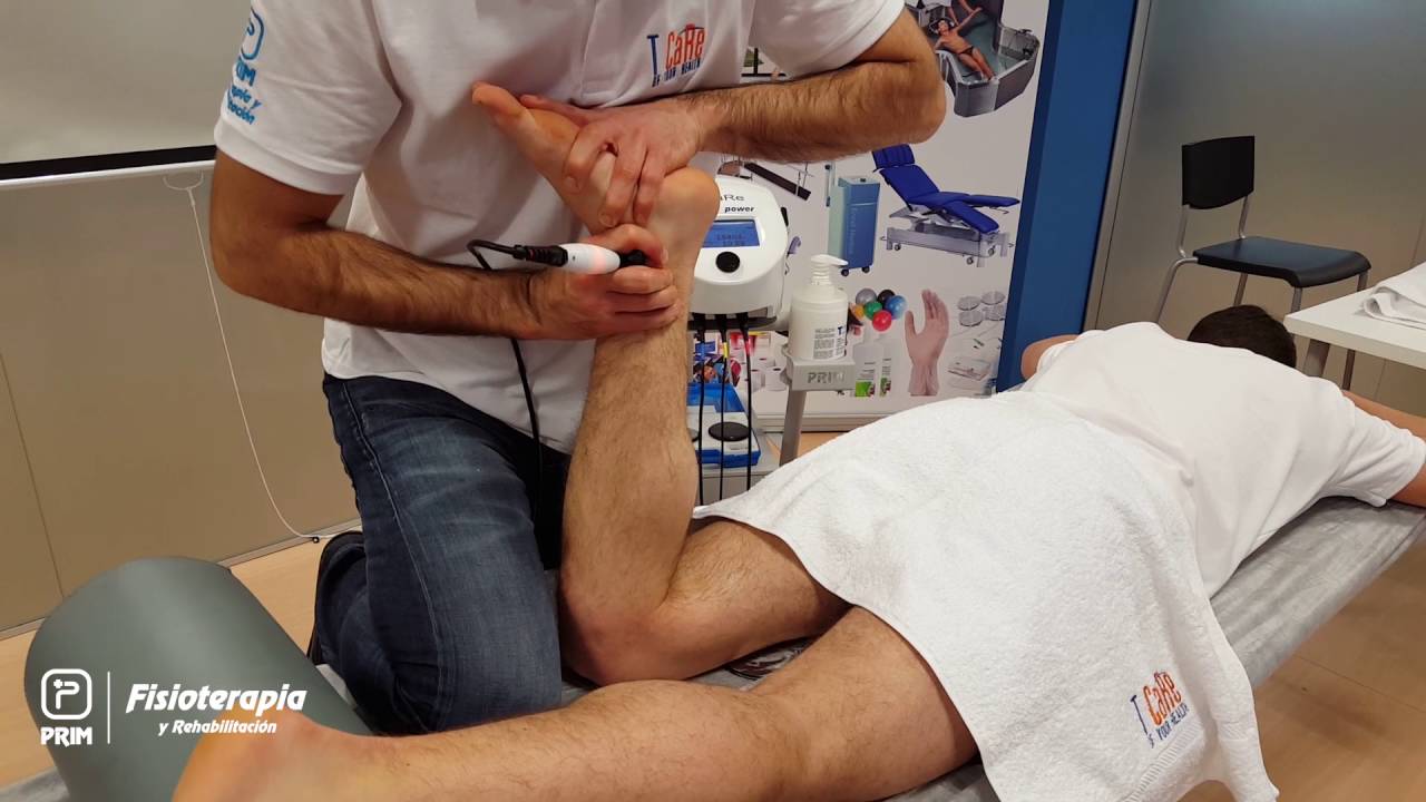 Diatermia T-Care - Esguince Tobillo
