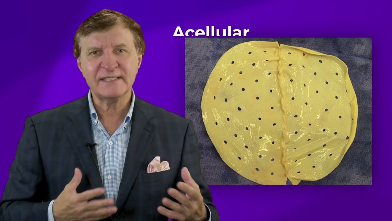 Acellular Dermal Matrix Complications: Plastic Surgery Hot Topics with Rod J. Rohrich, MD