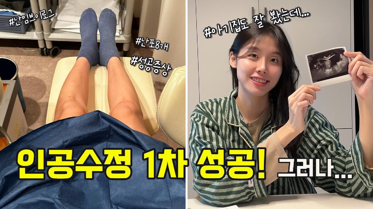 난임 브이로그 ep.2 인공수정 1차 성공!! 그러나... (과정, 성공증상, 과배란주사 6방, 난포8개, 질정 등)