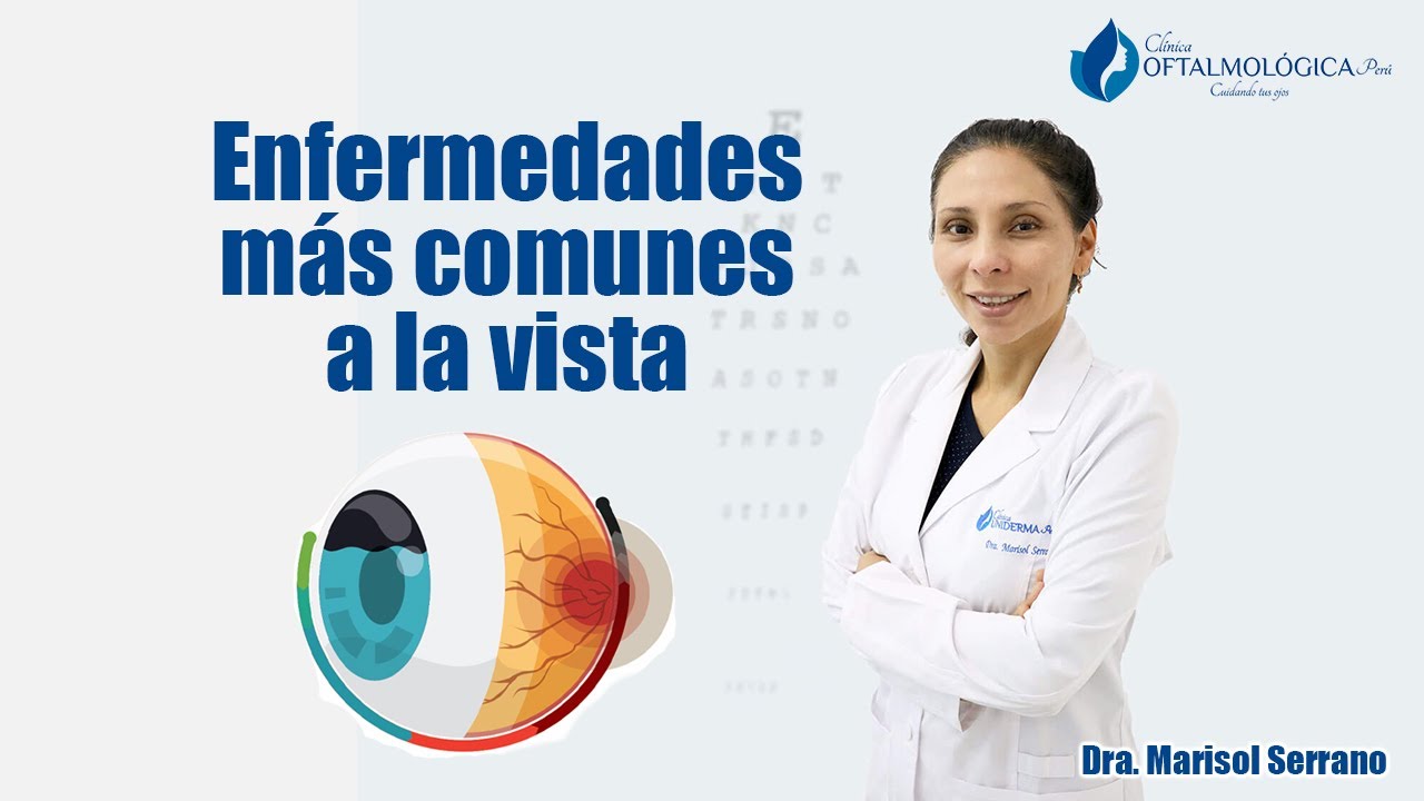 Cuales son las enfermedades mas comunes a la vista
