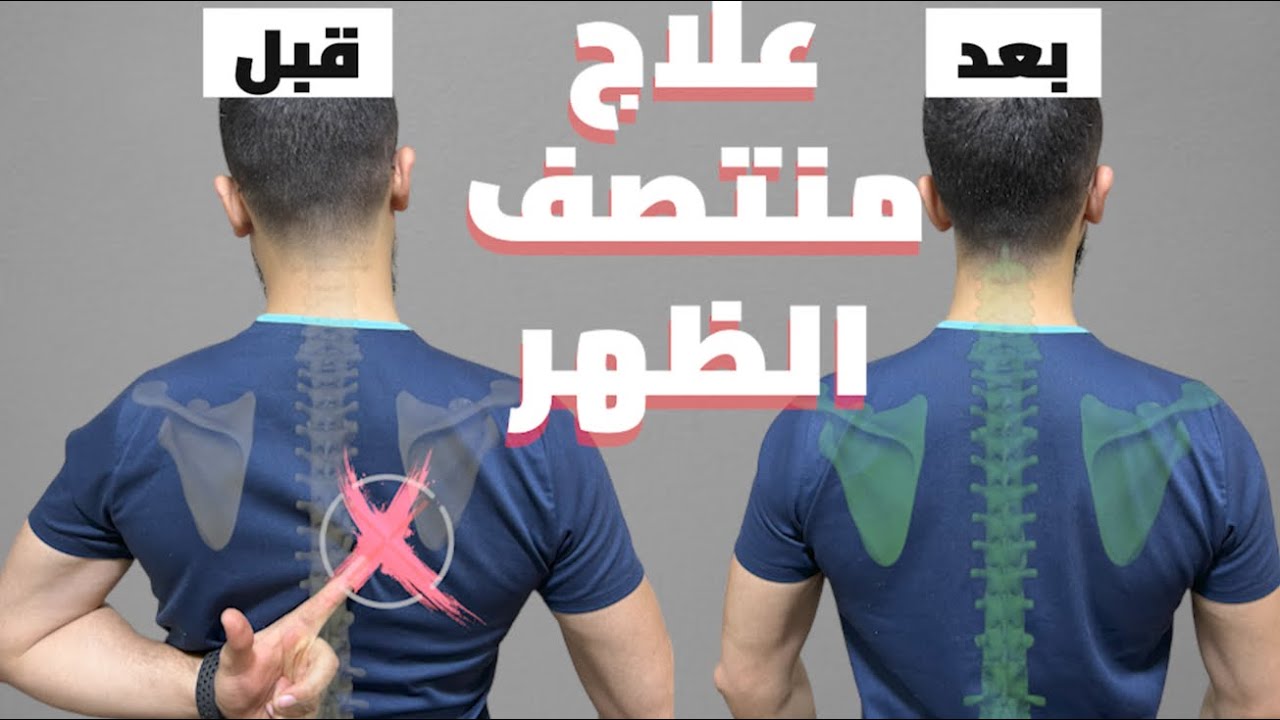 وجع الظهر بين الكتاف ؟ اعرف اسبابه وطرق العلاج👌