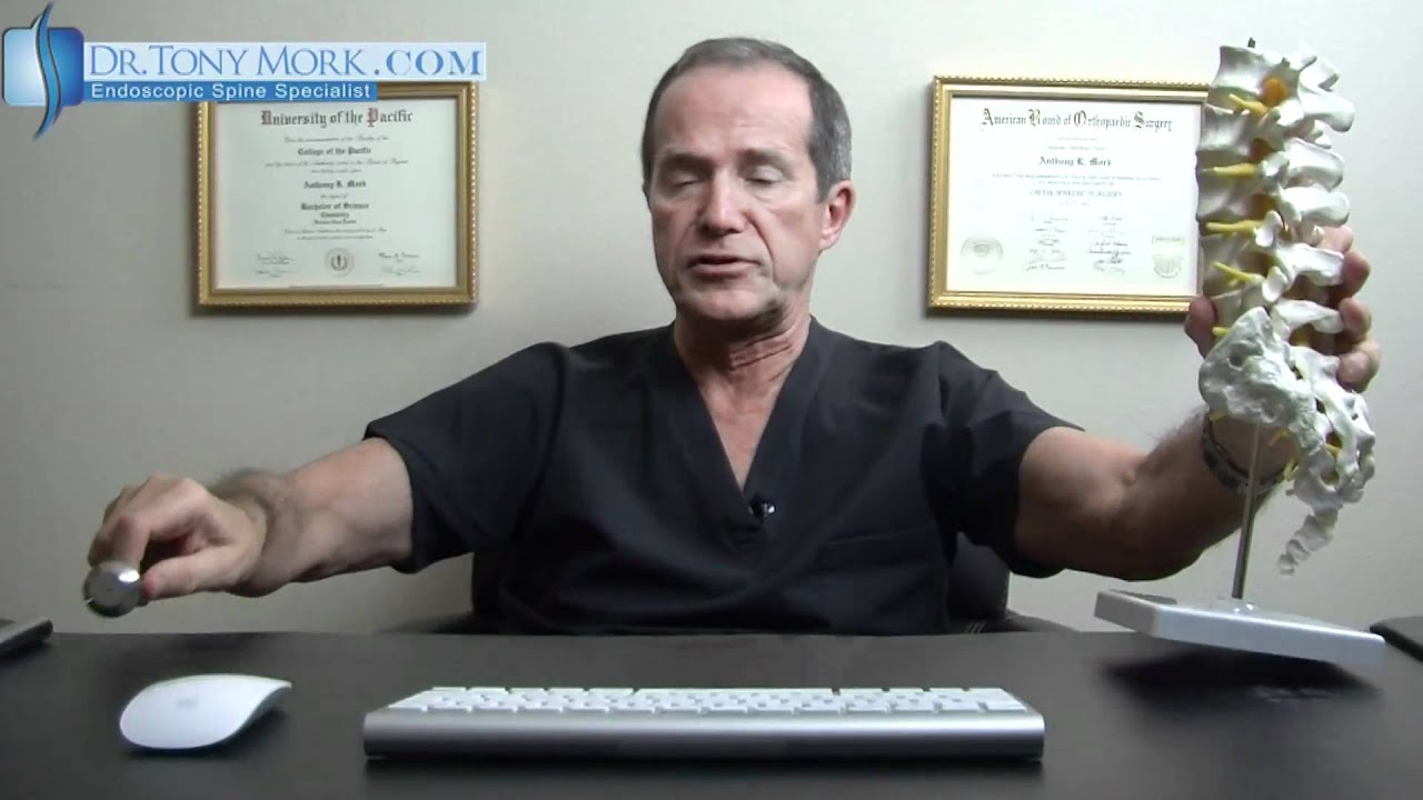 Endoscopic Laminoforaminoplasty - Overview by Dr. Tony Mork