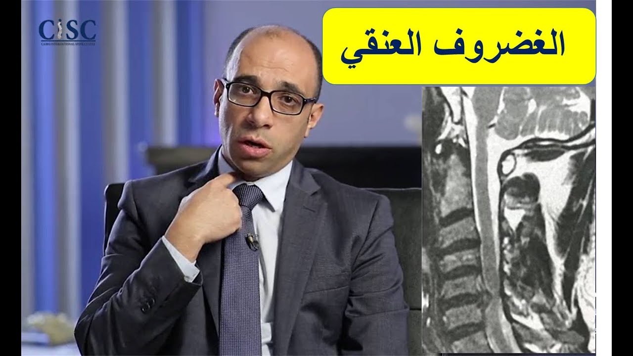 الغضروف العنقي، طريقة استئصالة جراحيا