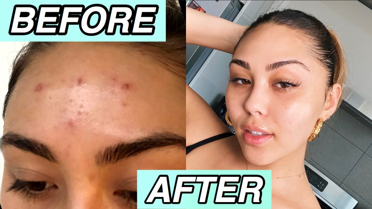 SKINCARE ROUTINE THAT CHANGED MY SKIN✨ *clear and glowy skin*
