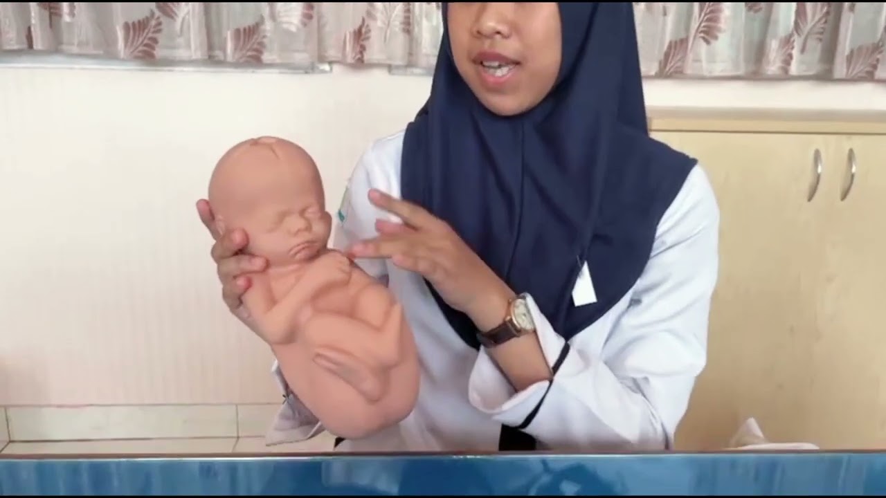 Kel 3 Ukuran Panggul, Ukuran Kepala Janin,  dan mekanisme persalinan 