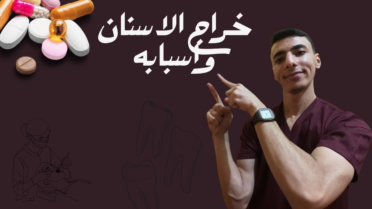 اسباب خراج العصب وعلاجه⁉️😨
