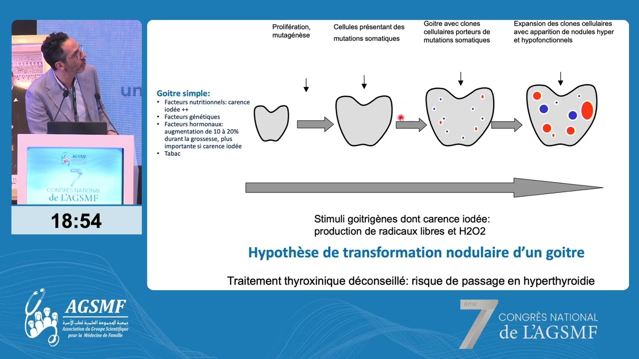 CAT devant un nodule thyroïdien Dr O Tazi