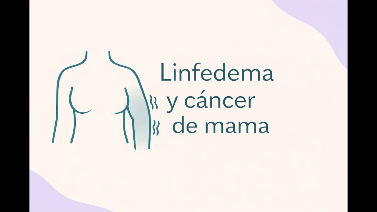 Linfedema y Cáncer de Mama: Qué es, cómo prevenirlo y cuidados clave