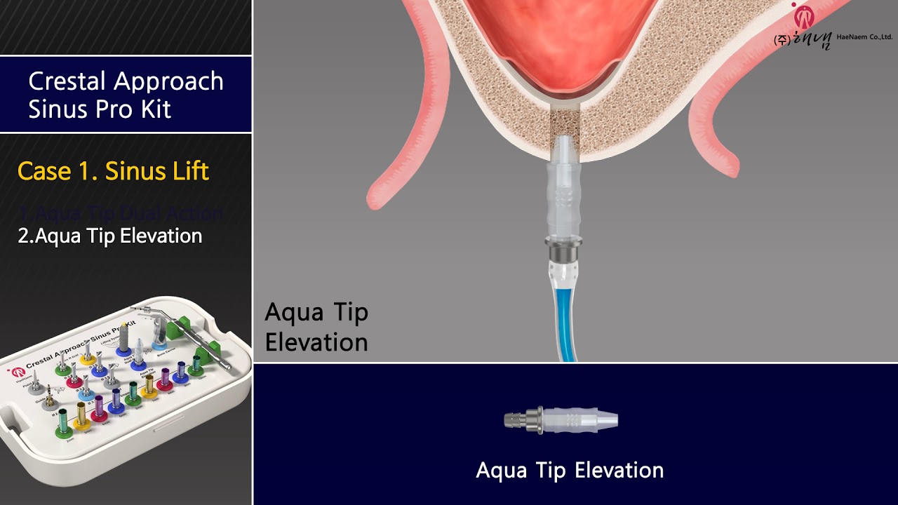 CRESTAL APPROACH SINUS PRO KIT - Haenaem Co., Ltd